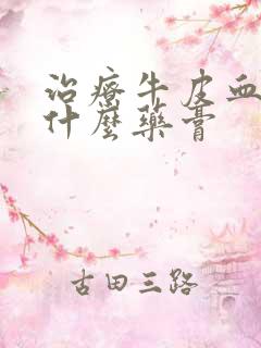 治疗牛皮血癣用什么药膏