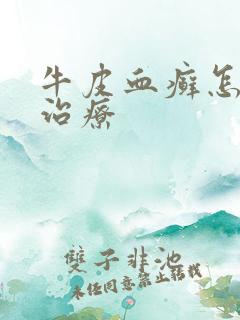 牛皮血癣怎么能治疗