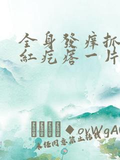 全身发痒抓了起红疙瘩一片一片的