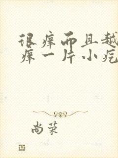 很痒而且越挠越痒一片小疙瘩