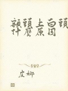 额头上白头发是什么原因