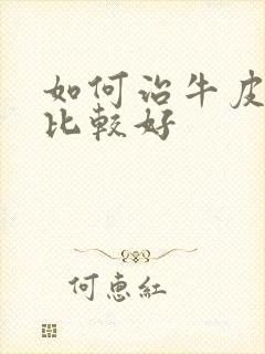 如何治牛皮有癣比较好