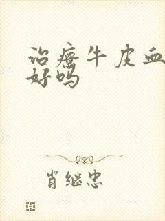 治疗牛皮血癣能好吗