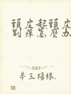 头皮起头皮屑特别痒怎么办