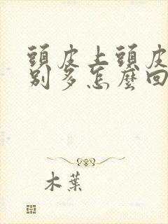 头皮上头皮屑特别多怎么回事