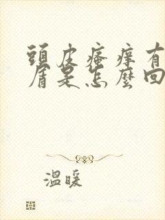 头皮瘙痒有头皮屑是怎么回事