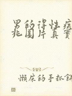 男的得性疾病前兆图片真实