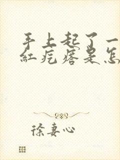 手上起了一些小红疙瘩是怎么回事