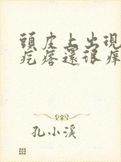 头皮上出现红色疙瘩还很痒怎么回事