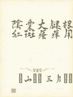 阴囊大腿根内侧红斑瘙痒用什么药膏