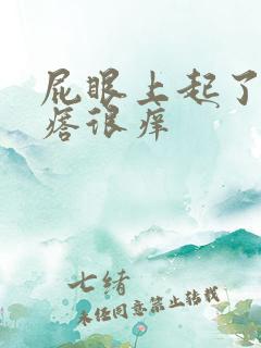 屁眼上起了些疙瘩很痒