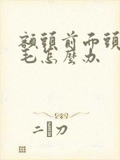 额头前面头发炸毛怎么办