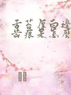 舌苔厚白边缘有齿痕是怎么办