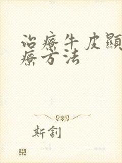 治疗牛皮显的治疗方法