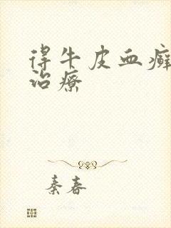 得牛皮血癣怎样治疗