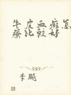 牛皮血癣怎样治疗比较好