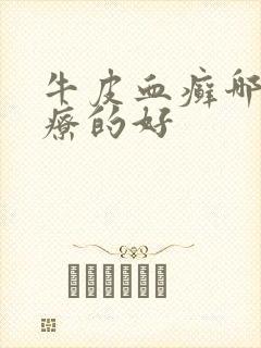 牛皮血癣哪里治疗的好