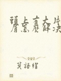 头上有大片头皮屑怎么解决