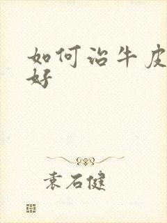 如何治牛皮有癣好