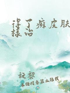 得了癣皮肤病怎样治