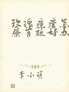 玫瑰痤疮怎样治疗有效好办法