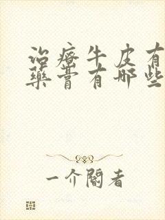 治疗牛皮有癣的药膏有哪些