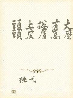 头上总有大块的头皮屑怎么回事