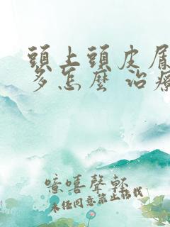 头上头皮屑特别多怎么 治疗