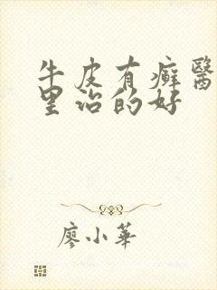 牛皮有癣医院哪里治的好