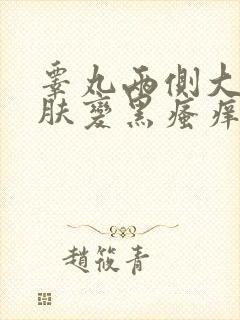 睾丸两侧大腿皮肤变黑瘙痒