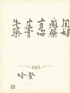 牛皮有癣用什么药膏治疗好的快些