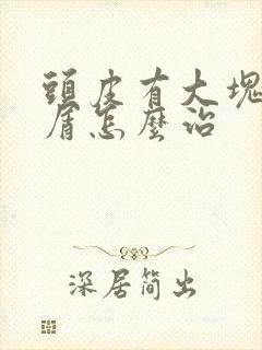 头皮有大块头皮屑怎么治