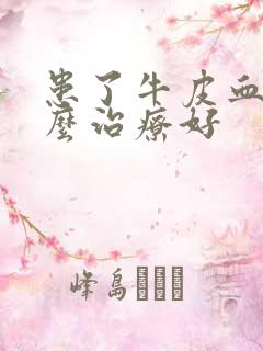 患了牛皮血癣怎么治疗好