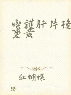 吃护肝片后尿液变黄