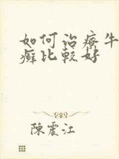 如何治疗牛皮有癣比较好