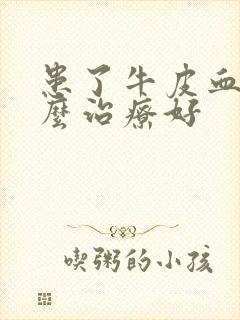 患了牛皮血癣怎么治疗好