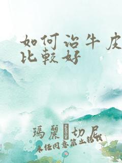 如何治牛皮有癣比较好