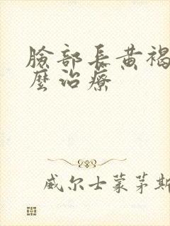 脸部长黄褐斑怎么治疗