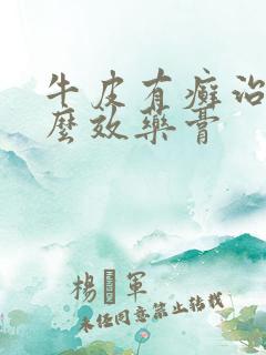 牛皮有癣治疗什么效药膏