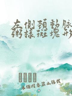 左侧颈动脉窦部粥样斑块形成