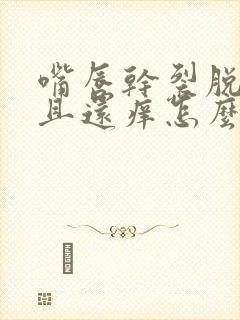 嘴唇干裂脱皮而且还痒怎么办