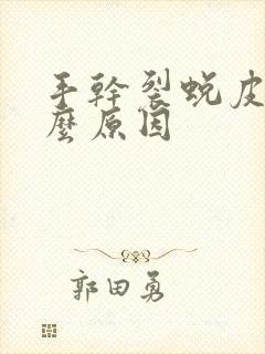 手干裂蜕皮是什么原因