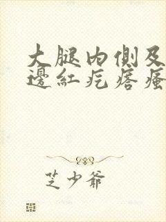 大腿内侧及睾丸边红疙瘩瘙痒