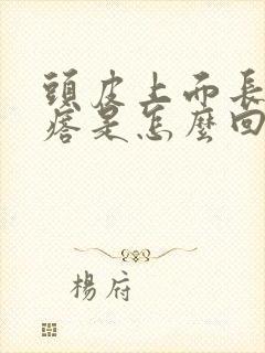 头皮上面长小疙瘩是怎么回事