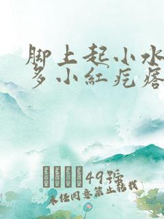 脚上起小水泡很多小红疙瘩 还有水