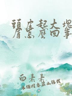 头皮起大块头皮屑怎么回事