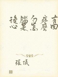 后脑勺疼有点恶心是怎么回事