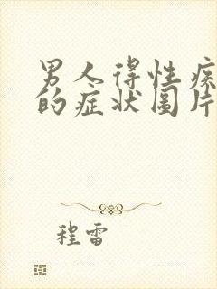 男人得性疾病扰的症状图片有哪些