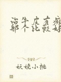 治牛皮有癣医院那个比较好