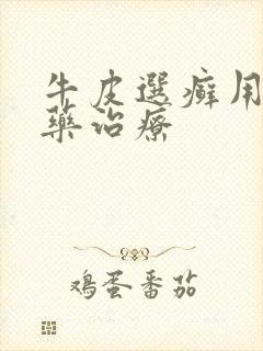 牛皮选癣用什么药治疗